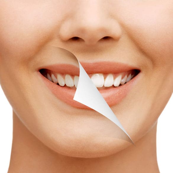 smile-designing-lucknow